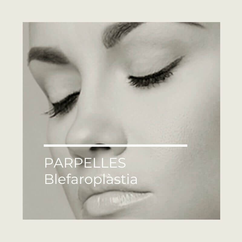 parpelles cirurgia plastica idermic