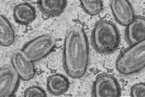 Viruela del mono: Qué es, síntomas, transmisión y prevención.