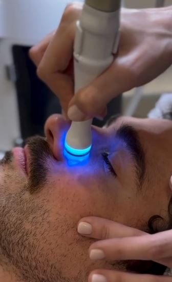 Limpieza facial con Aquapure