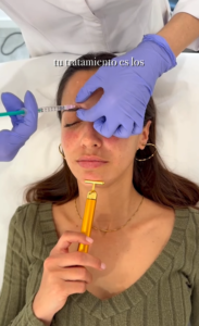 Tratamiento de las arrugas en el tercio superior con neuromoduladores.