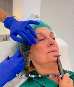 Soporte estructural Soporte estructural