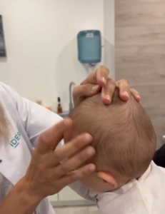 Costra láctea en bebés Todo lo que debes saber sobre la costra láctea en bebés