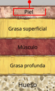 En la capa superficial con la pérdida de colágeno y elastina se pueden utilizar Bioestimuladores de colágeno y Radiofrecuencia fraccionada con agujas contra la flacidez facial.
