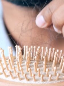 Efluvio telógeno Efluvio telógeno: causas, síntomas y tratamiento de una caída de cabello temporal
