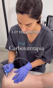 Tratamiento para reducir la grasa localizada con carboxiterapia