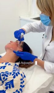 Aquapure. Tratamiento para poros dilatados