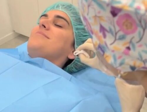 Lobuloplastia: la cirugía estética que repara y rejuvenece los lóbulos de la oreja