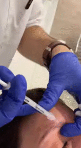 Repoblamiento de cejas: los mejores tratamientos disponibles
