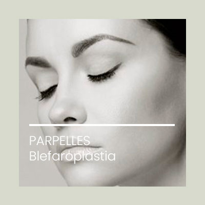Cirugia plastica facial blefaro. Clinica Idermic