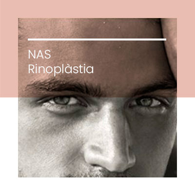 Cirugia plastica facial nas. Clinica Idermic