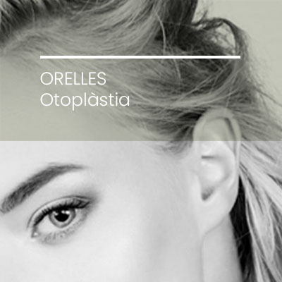 Cirugia plastica facial otoplastia. Clinica Idermic