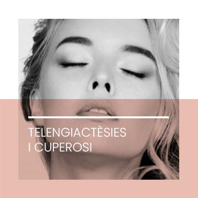 Estetica Facial Cuperosi. Clínica Idermic.