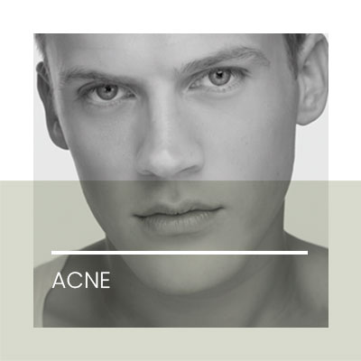 Acne. Clínica Idermic