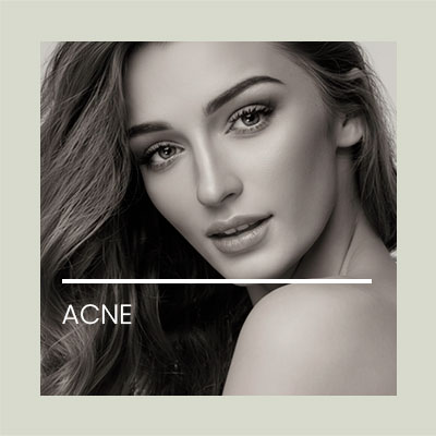 Láser Acne. Clinica Idermic