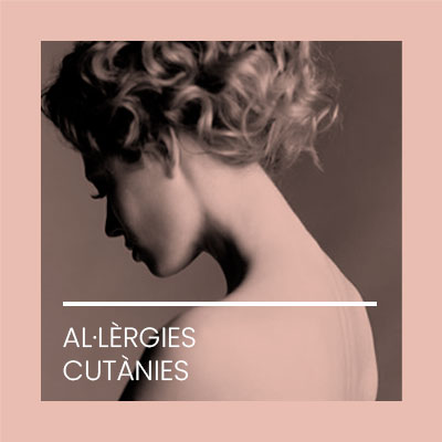 Alergies cutanies. Clínica Idermic