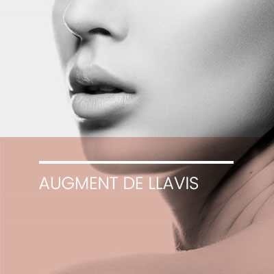 Augment llavis. Clínica Idermic.