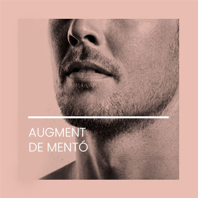 Augment mento. Clínica Idermic.