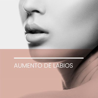 Aumento de labios. Clínica Idermic