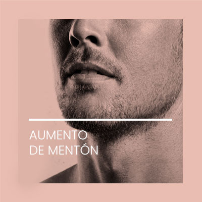 Aumento de mentón. Clínica Idermic