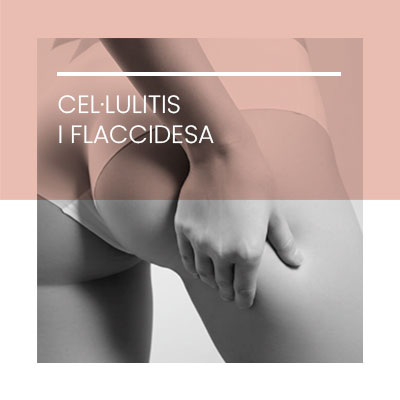 Celulitis flaccidesa. Clínica Idermic.