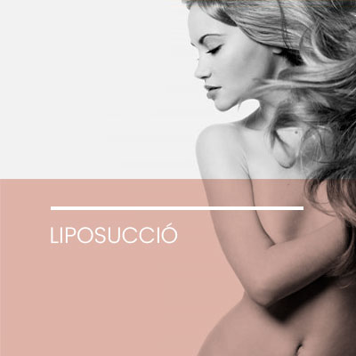 Liposuccio. Clínica Idermic