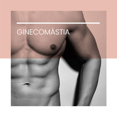 Ginecomastia. Clínica Idermic