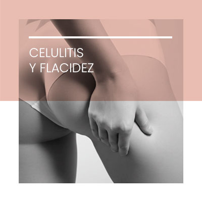 Tratamiento de la celulitis y flaccidez. Clínica Idermic