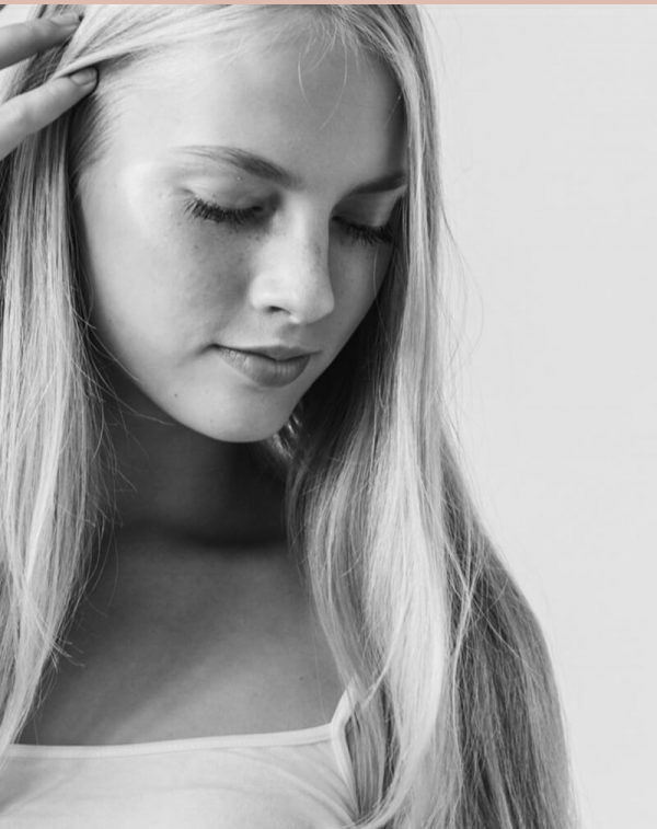 dermatologia_estetica_tractament_marques_acne_idermic-600×757 Dermatología estética. Marcas de acné. Clínica Idermic