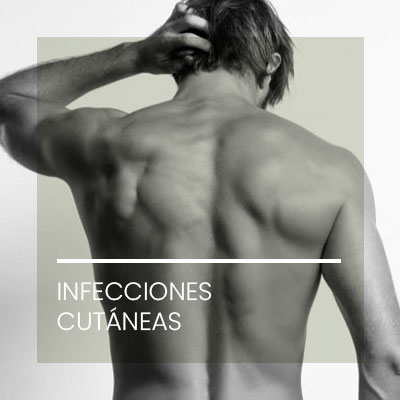 Infecciones cutáneas. Dermatología Clínica en Idermic.