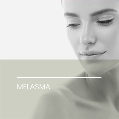 Melasma. Dermatología Clínica en Idermic.