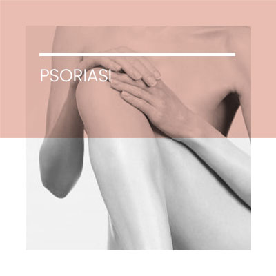Psoriasi. Clínica Idermic