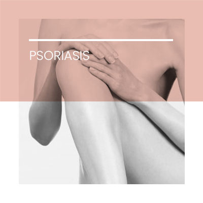 Psoriasis. Dermatología Clínica en Idermic.
