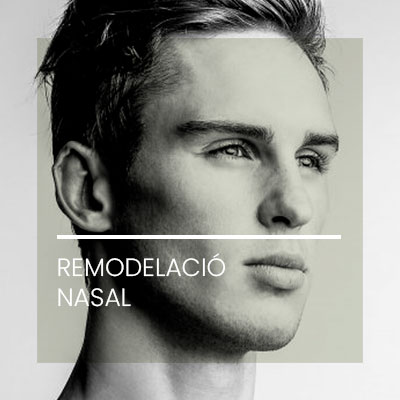 Remodelacio nasal. Clínica Idermic.