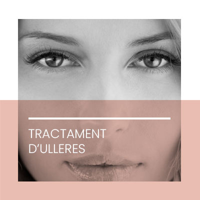 Tractament ulleres. Clínica Idermic.