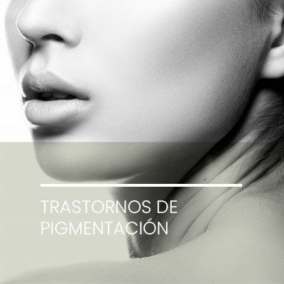 Trastornos de pigmentación. Dermatología Clínica en Idermic.