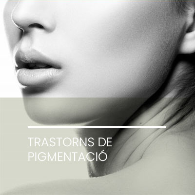 Trastorns pigmentacio. Clínica Idermic