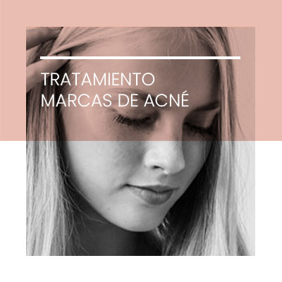 Tratamiento marcas acne. Clínica Idermic