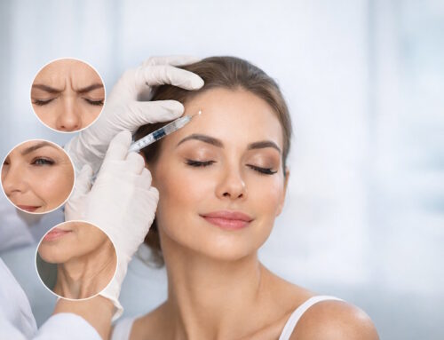 Neuromoduladores: qué son, cómo funcionan y por qué se utilizan en medicina estética
