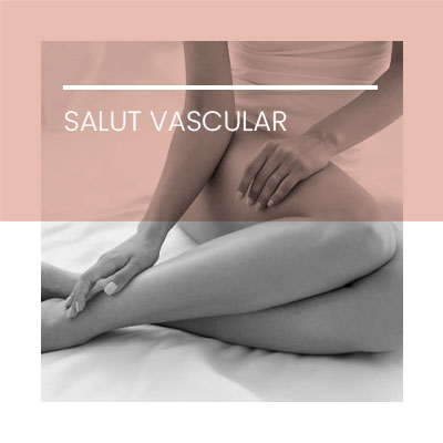 Salut Vascular. Clínica Idermic Terrassa