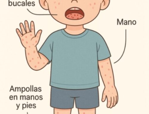 Virus boca, mà, peu: tot el que cal saber sobre aquesta malaltia vírica infantil