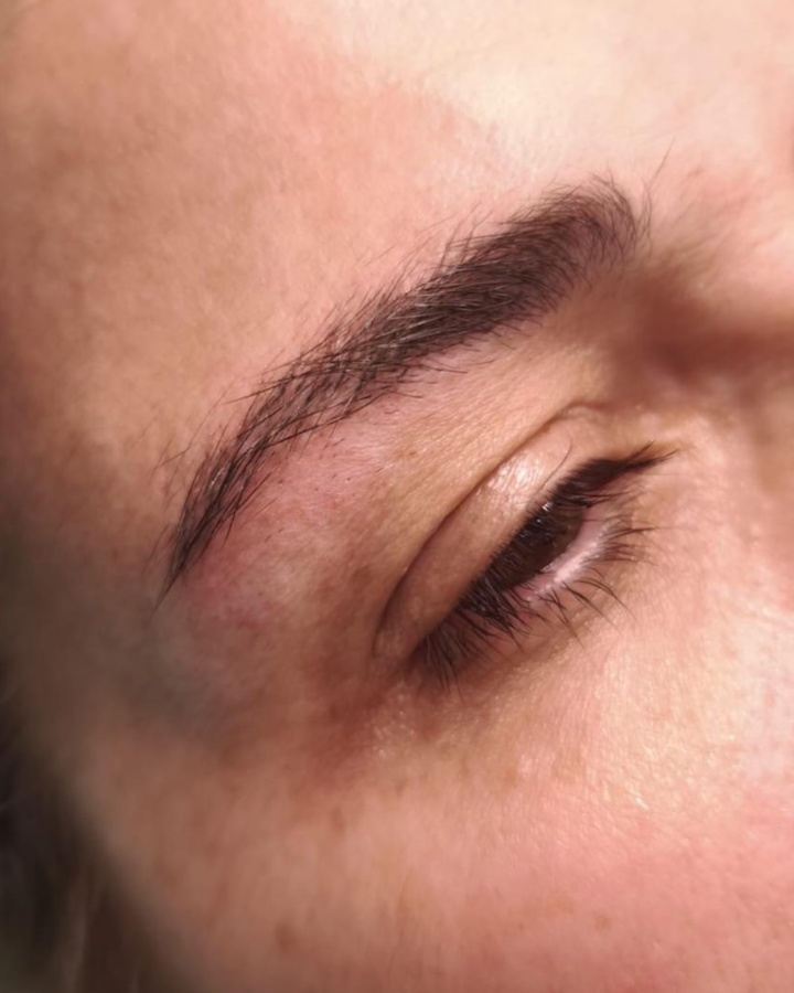 Micropigmentación Médica y Estética Tratamientos de Micropigmentación Médica y Estética Clínica Idermic de Terrassa. Diseño de cejas pelo a pelo-1