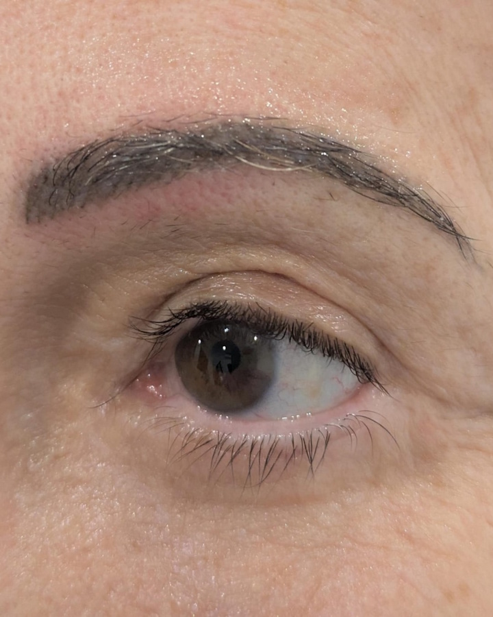 Micropigmentación Médica y Estética Tratamientos de Micropigmentación Médica y Estética Clínica Idermic de Terrassa. Diseño de cejas pelo a pelo-3