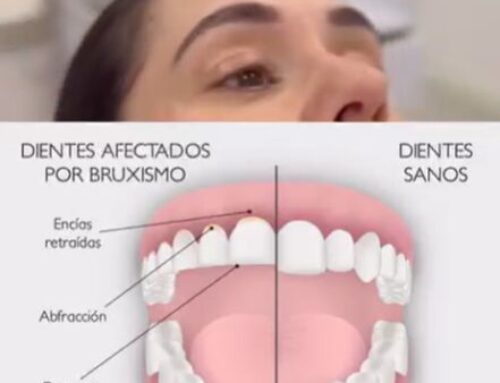 Bruxisme: tot el que necessitem saber sobre l’hàbit de grinyolar les dents
